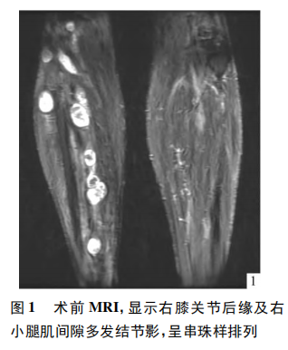 点击查看原图 图1.png