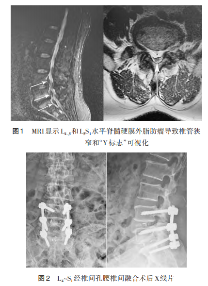图.png