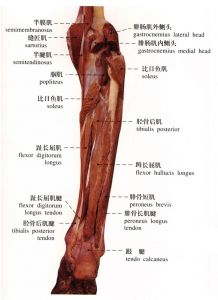 跟腱断裂