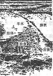 前置胎盘