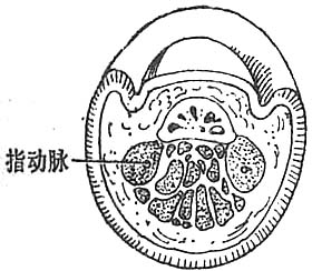 脓性指头炎