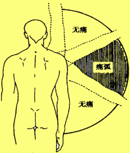 疼痛弧试验