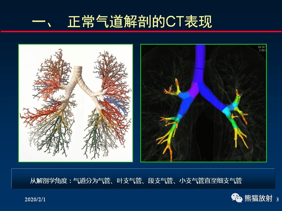 【PPT】精准判读支气管感染的基本CT表现