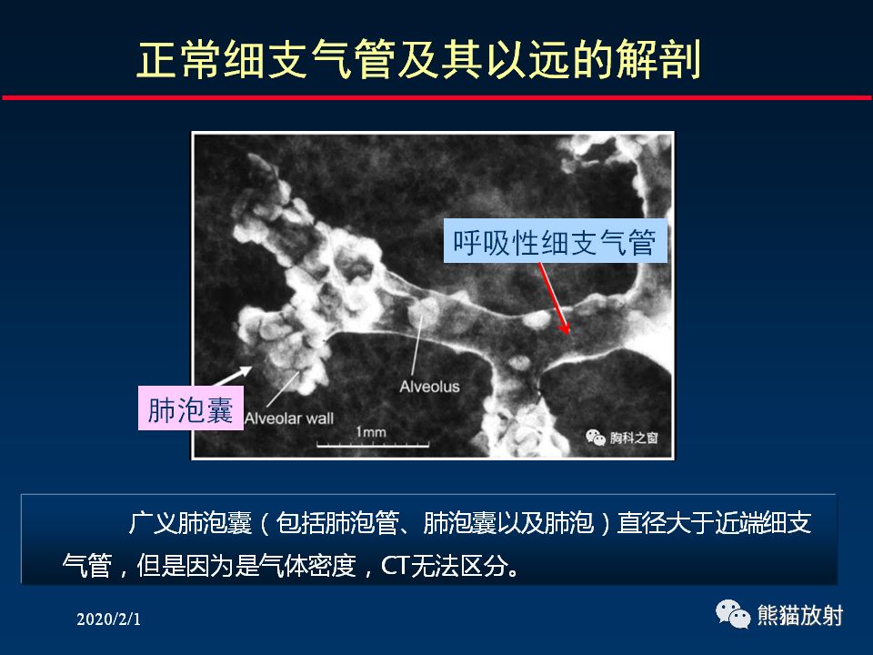 【PPT】精准判读支气管感染的基本CT表现