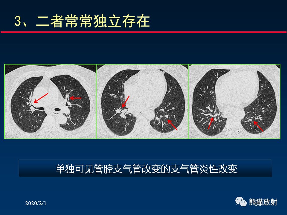 【PPT】精准判读支气管感染的基本CT表现
