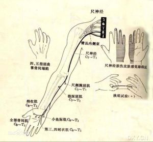 尺神经走行