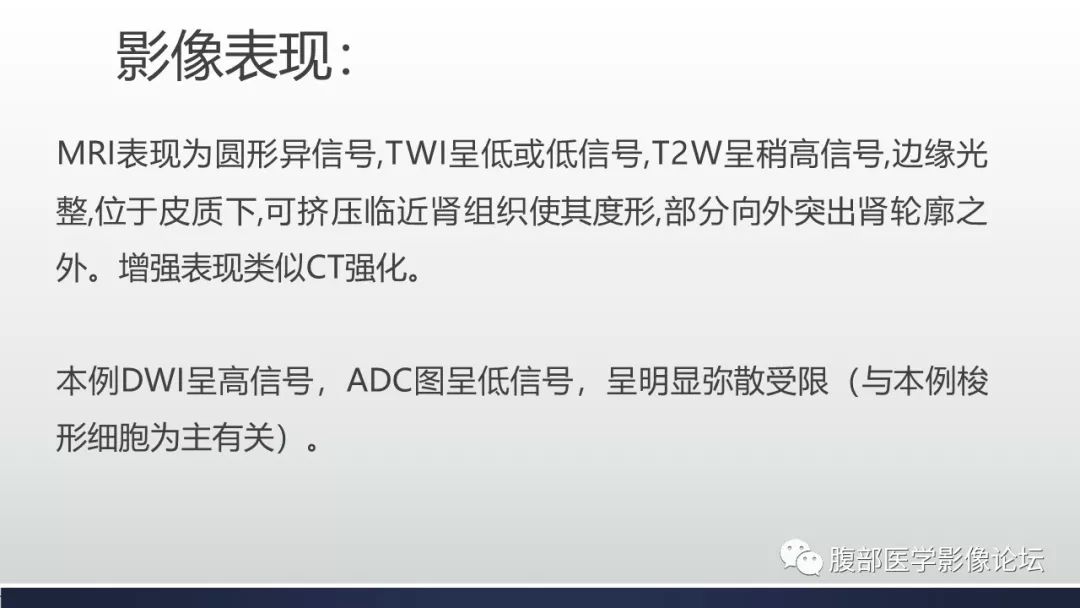 【病例】左肾混合性上皮间质肿瘤1例CT及MR影像