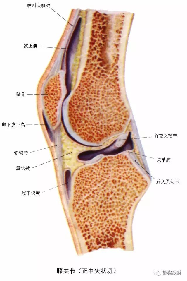 前交叉韧带损伤MRI 征象