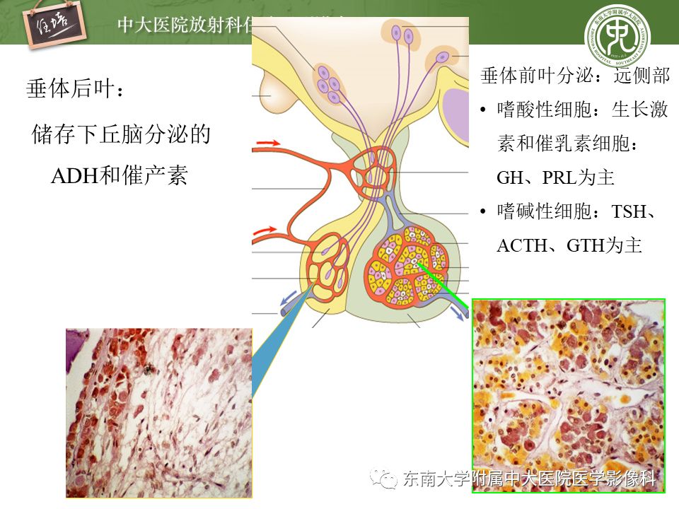 【PPT】垂体正常及常见疾病影像表现