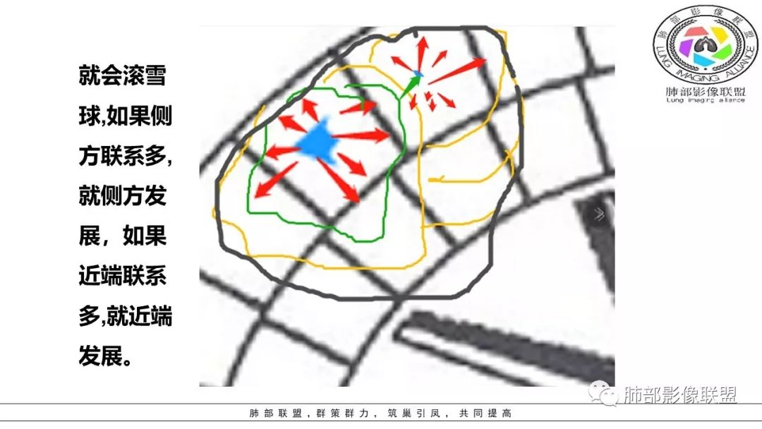 【PPT】病毒肺炎影像机制探讨