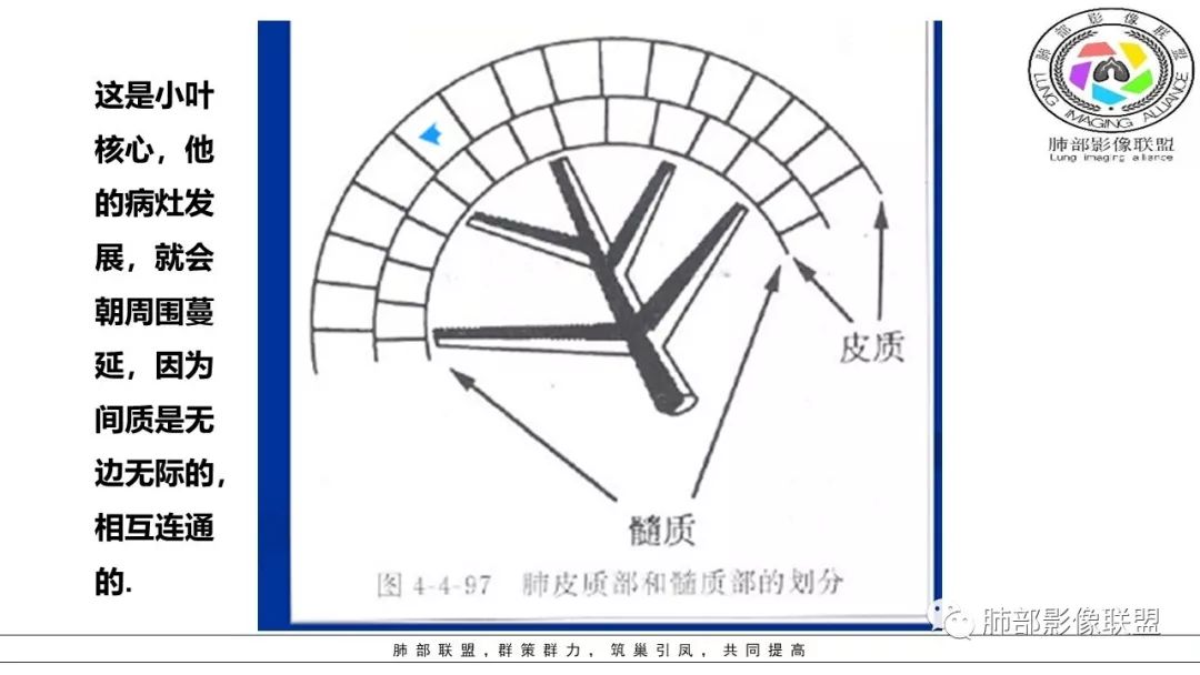 【PPT】病毒肺炎影像机制探讨