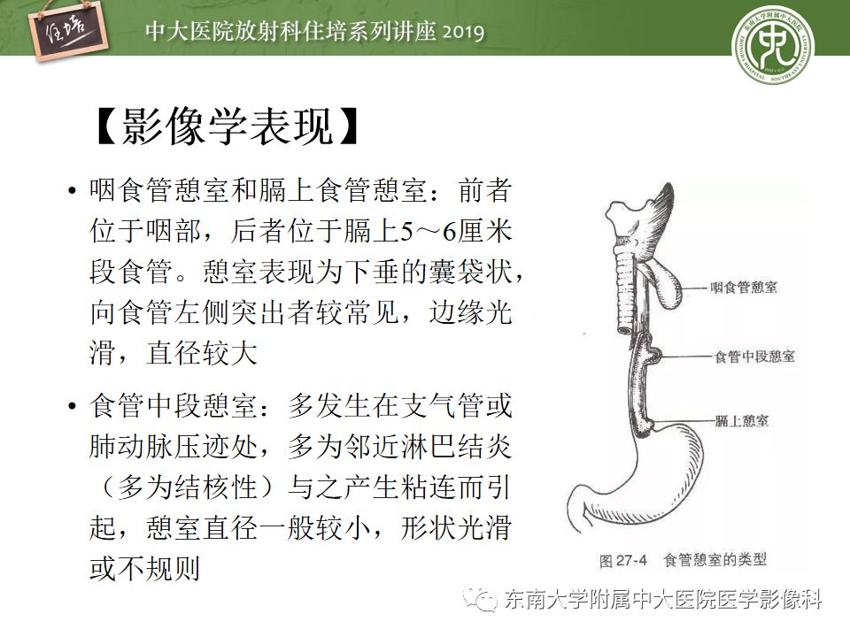 【PPT】食管常见疾病的诊断和鉴别诊断