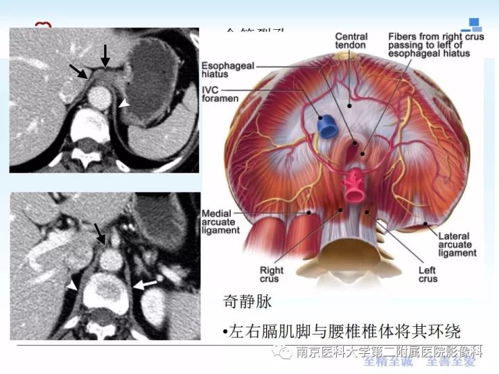 【PPT】膈肌的解剖及病变
