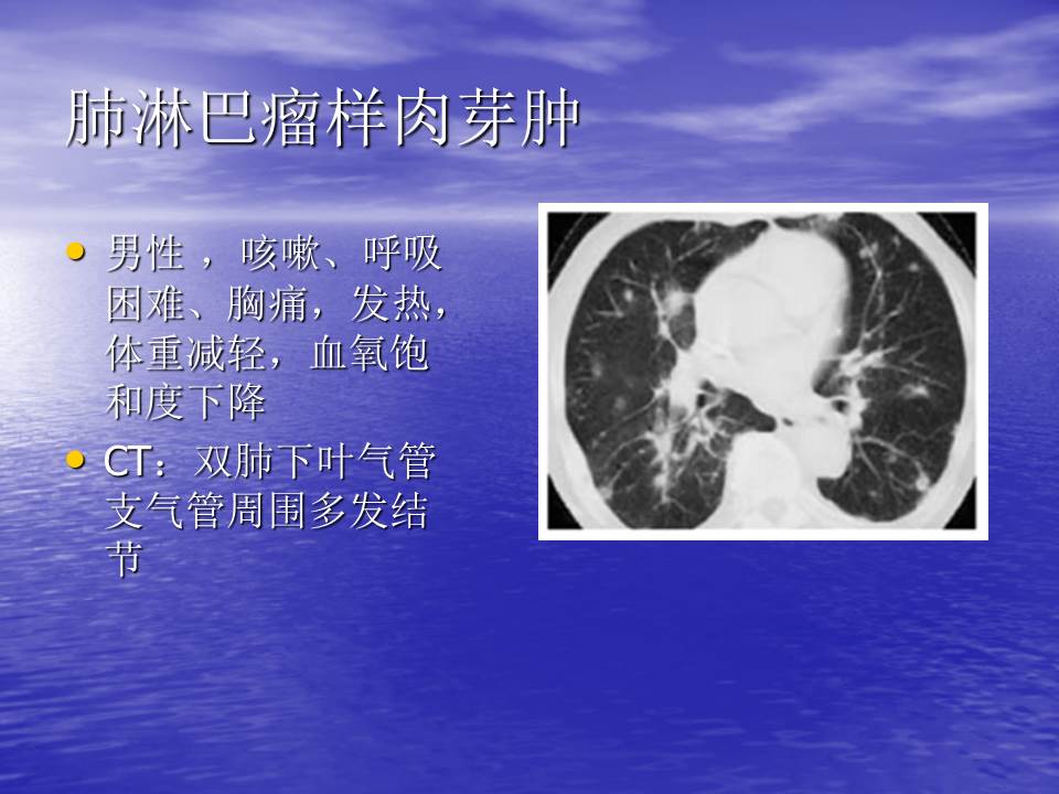 幻灯片106