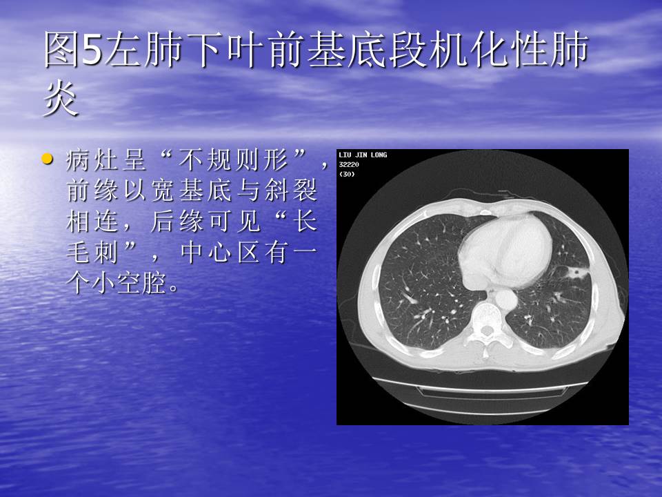 幻灯片122