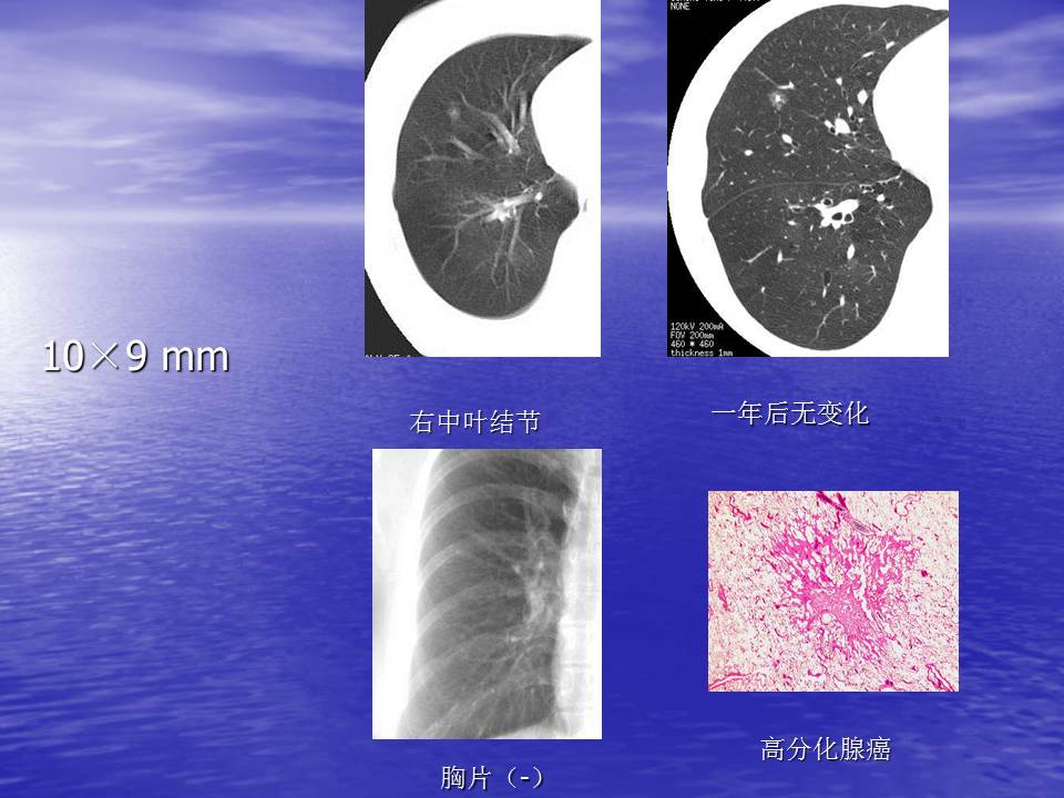 幻灯片39