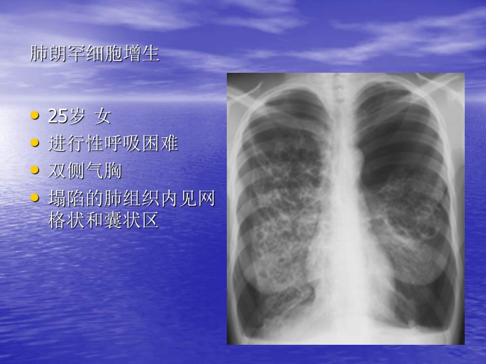 幻灯片102