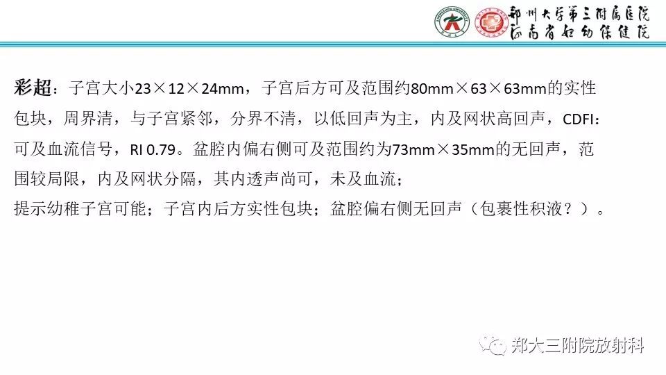 【病例】卵巢无性细胞瘤1例MR影像 【病例】卵巢无性细胞瘤1例MR影像