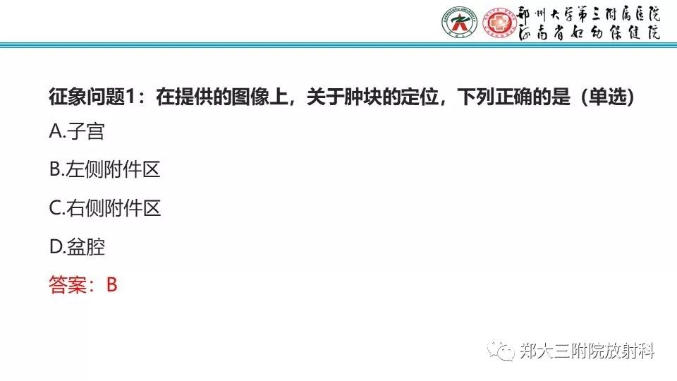 【病例】卵巢无性细胞瘤1例MR影像 【病例】卵巢无性细胞瘤1例MR影像