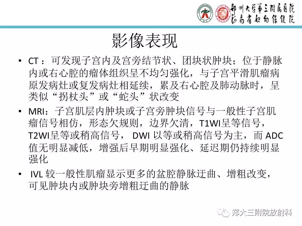 【病例】子宫静脉内平滑肌瘤病1例MR影像