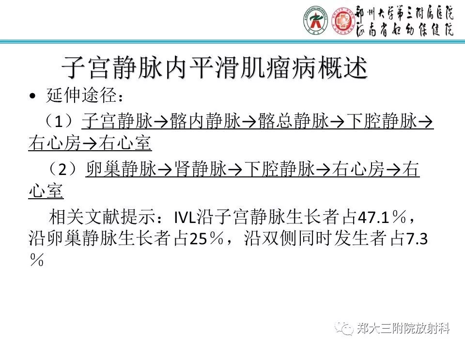 【病例】子宫静脉内平滑肌瘤病1例MR影像