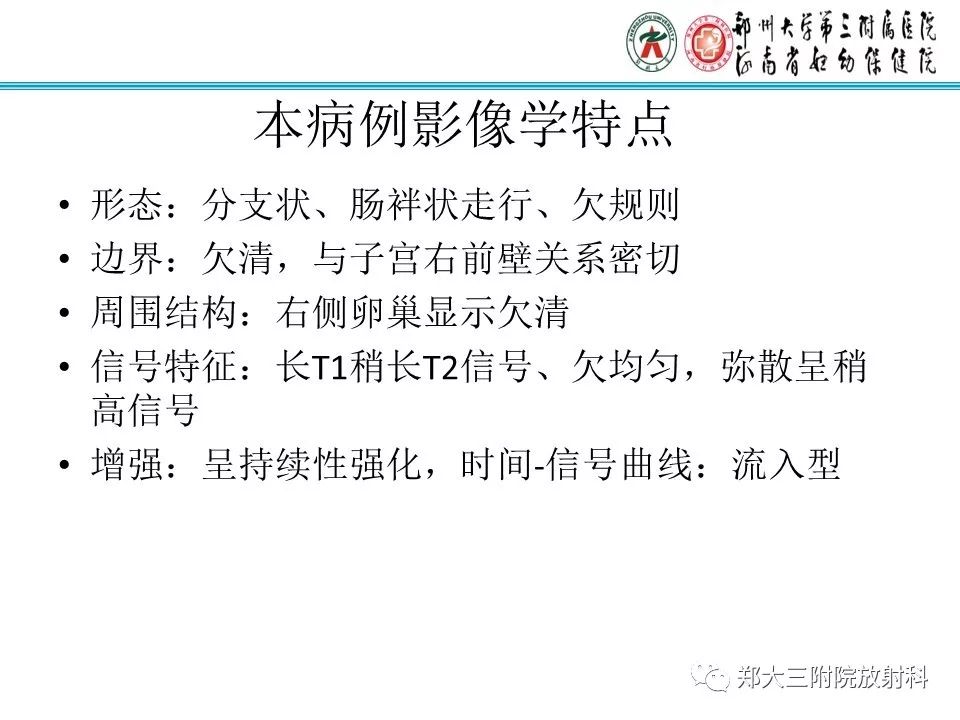【病例】子宫静脉内平滑肌瘤病1例MR影像