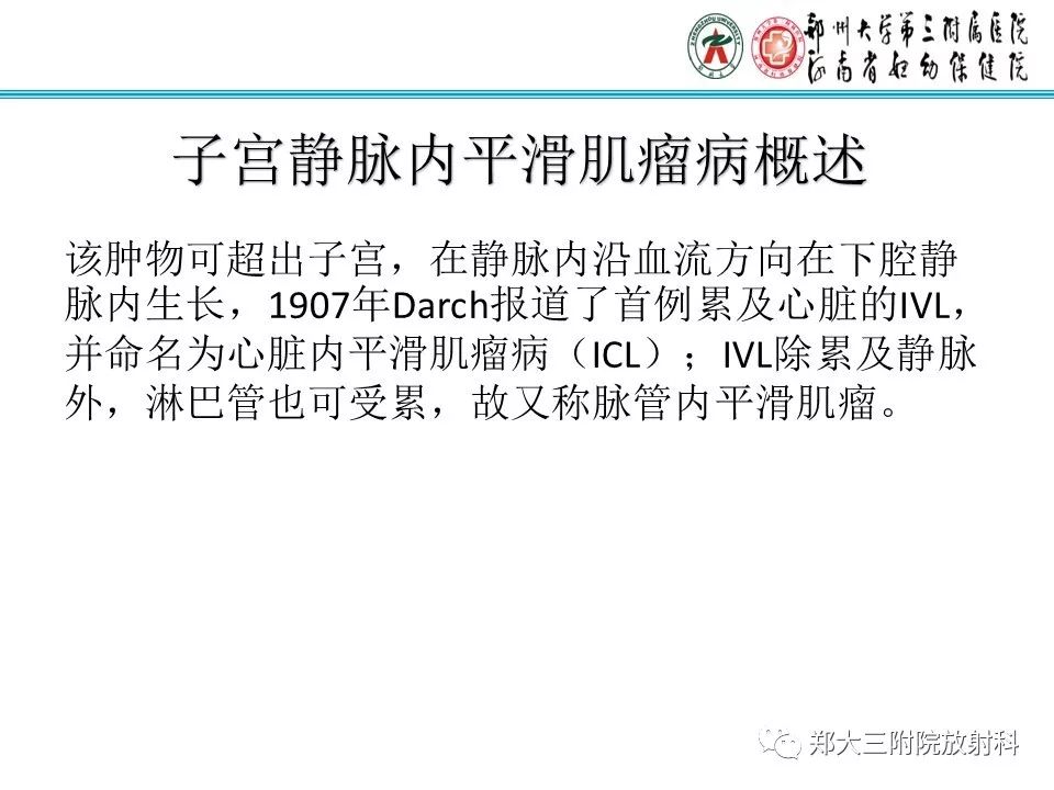 【病例】子宫静脉内平滑肌瘤病1例MR影像