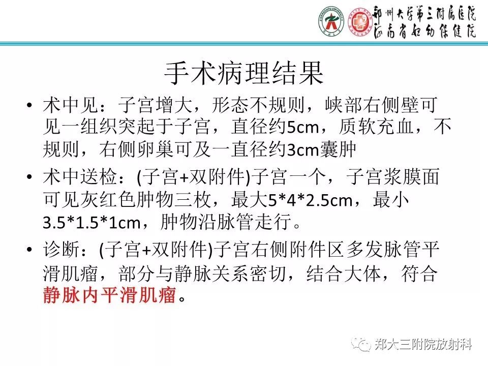 【病例】子宫静脉内平滑肌瘤病1例MR影像