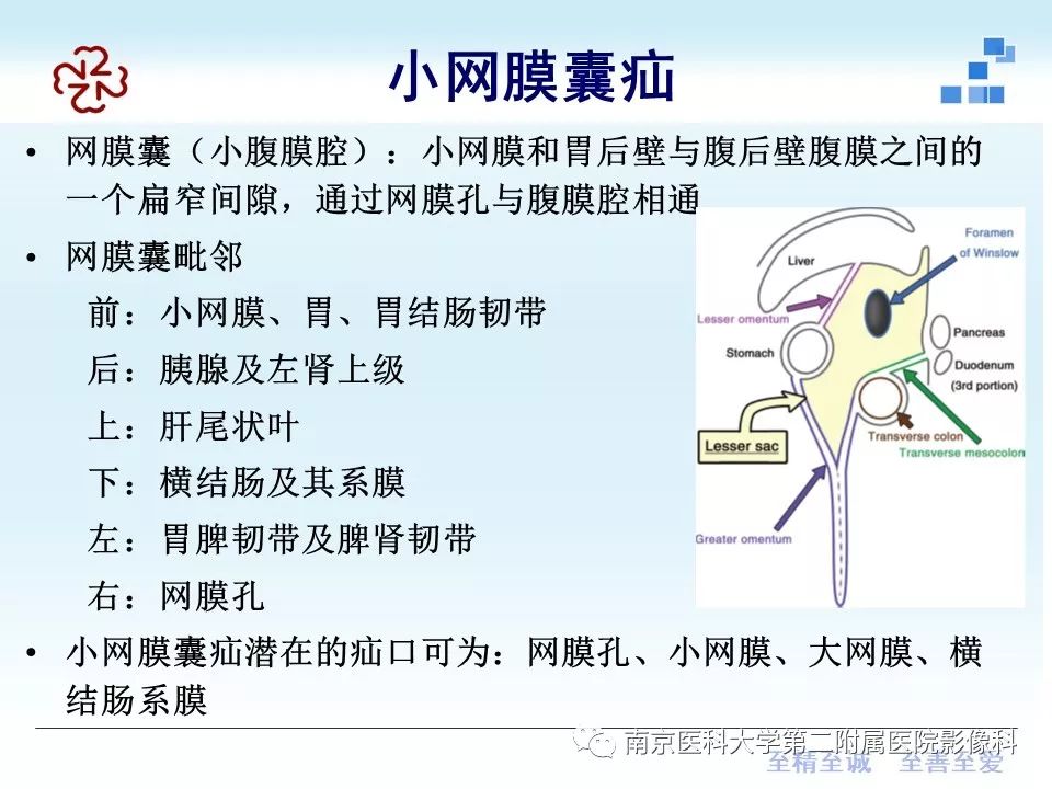 【PPT】腹内疝的CT表现