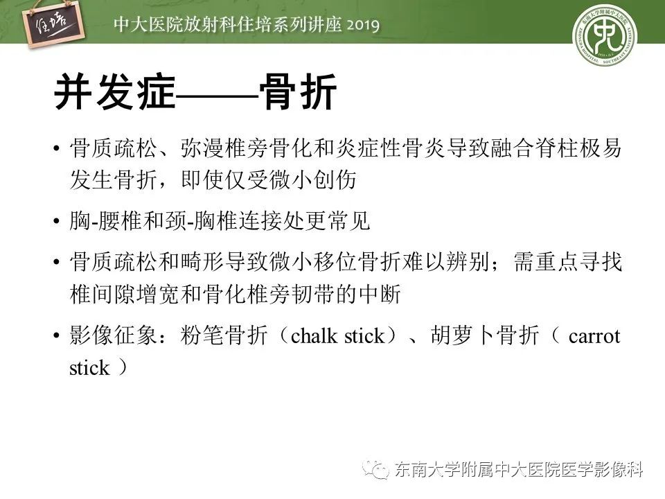 【PPT】强直性脊柱炎影像学评估