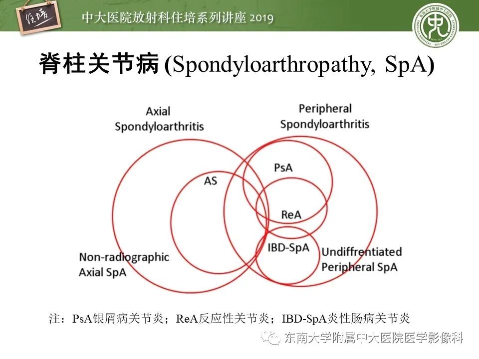 【PPT】强直性脊柱炎影像学评估