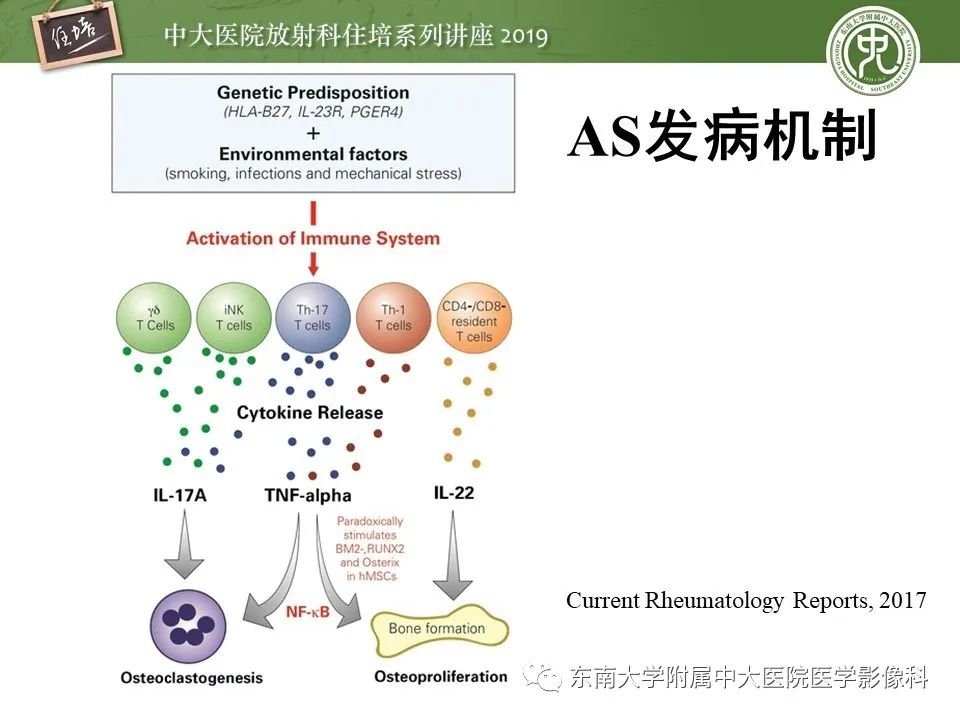 【PPT】强直性脊柱炎影像学评估