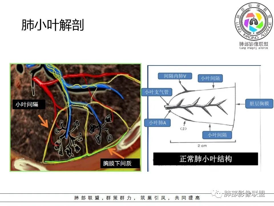 【PPT】如何快速掌握新冠肺炎（NCP）的影像识别？