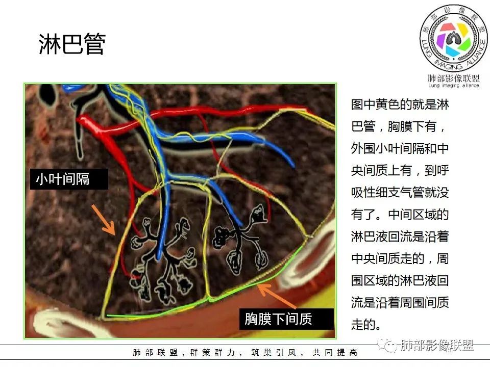 【PPT】如何快速掌握新冠肺炎（NCP）的影像识别？