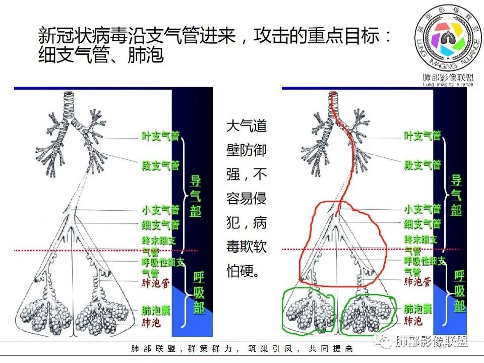【PPT】如何快速掌握新冠肺炎（NCP）的影像识别？