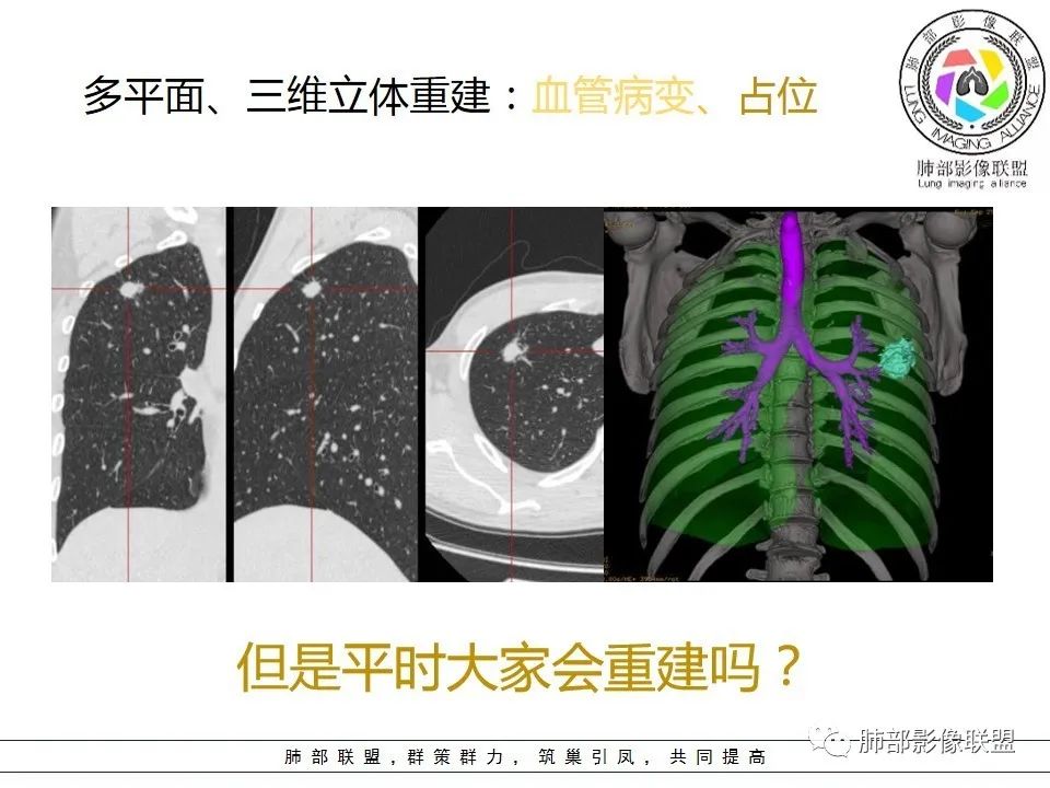 【PPT】如何快速掌握新冠肺炎（NCP）的影像识别？