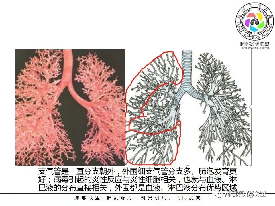 【PPT】如何快速掌握新冠肺炎（NCP）的影像识别？