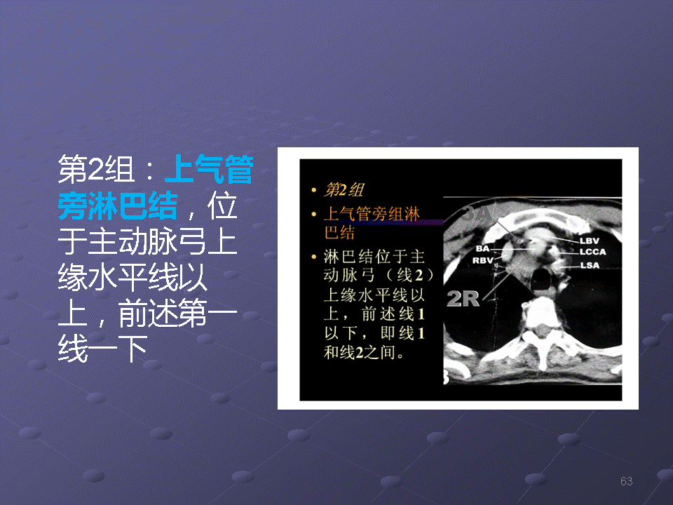幻灯片63