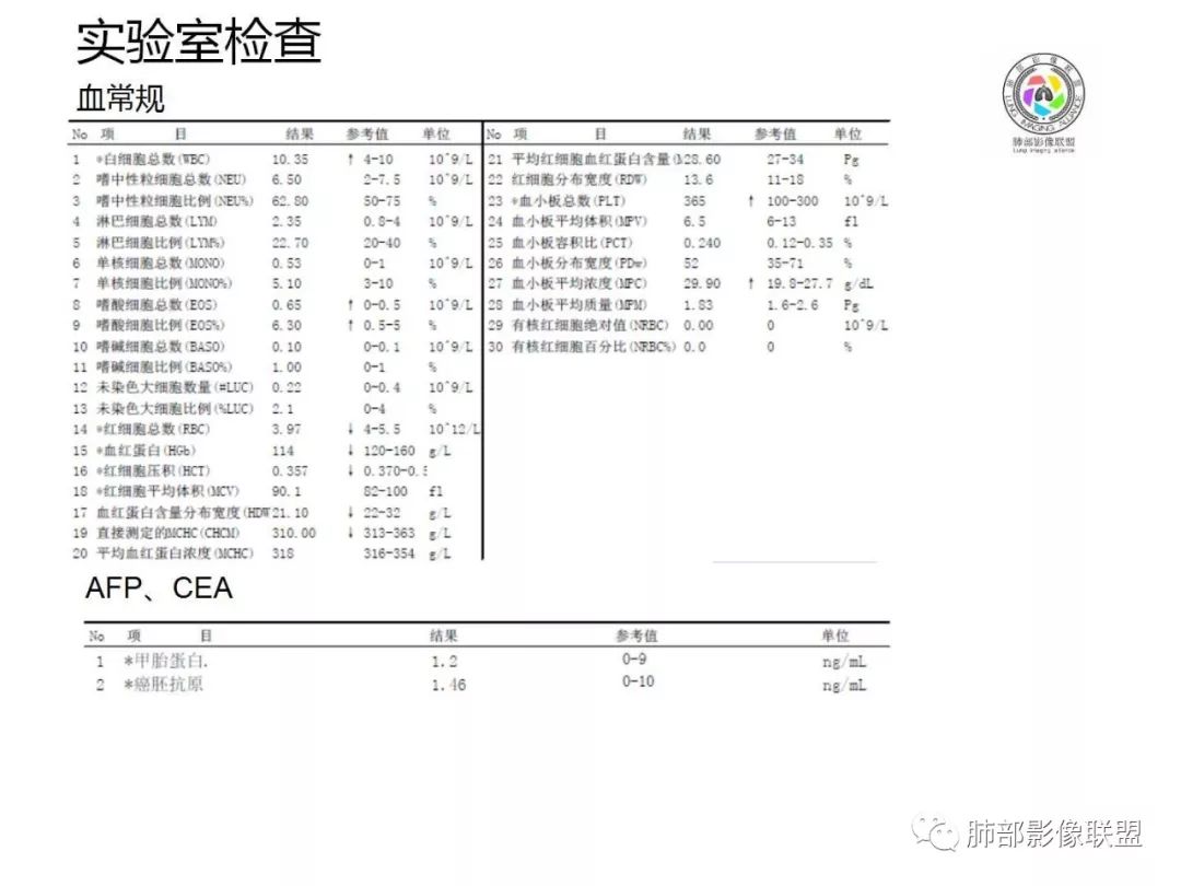 【病例】妖魔合体—你想不到的肉瘤样癌
