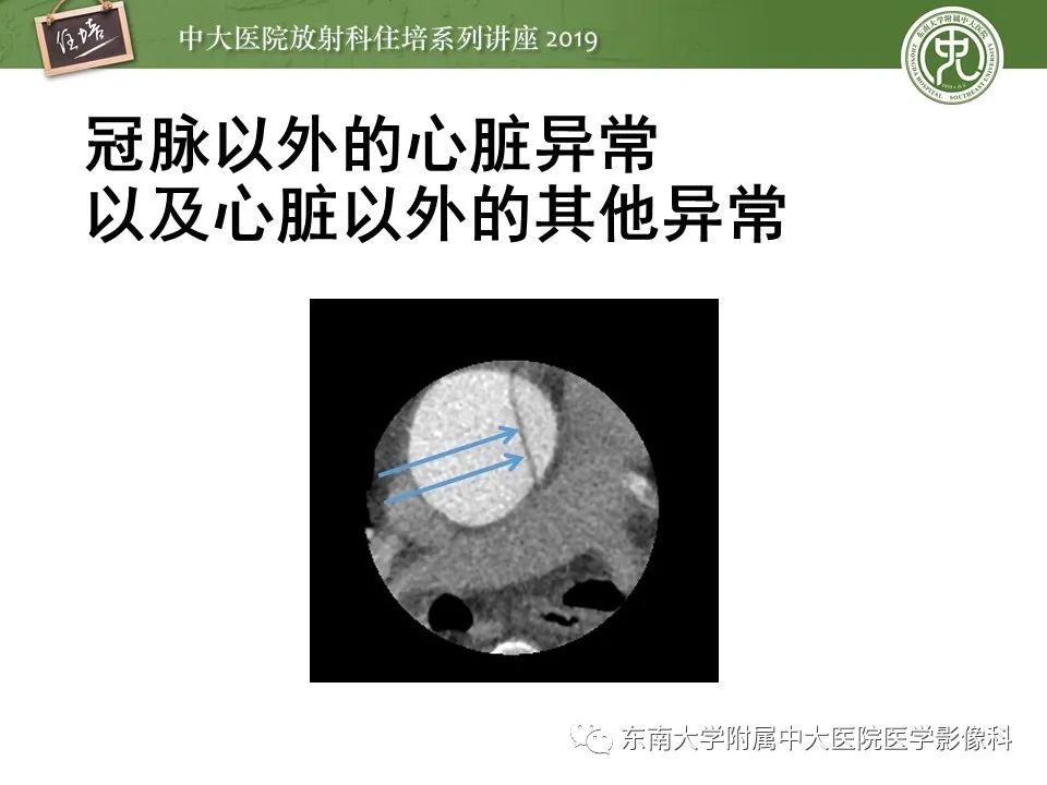 【PPT】冠状动脉CTA诊断流程