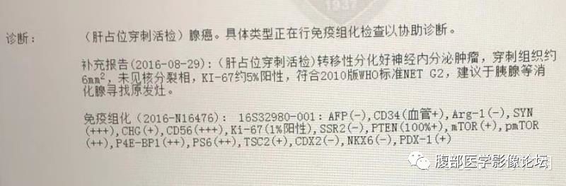 【病例】肝脏