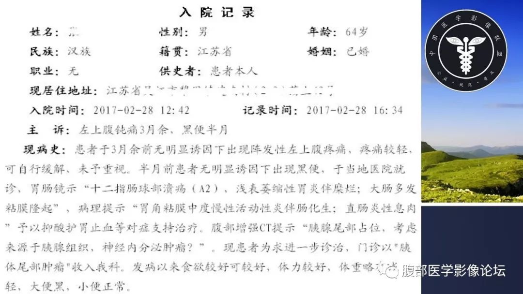 【病例】胰尾局灶性慢性胰腺炎1例MR影像讨论