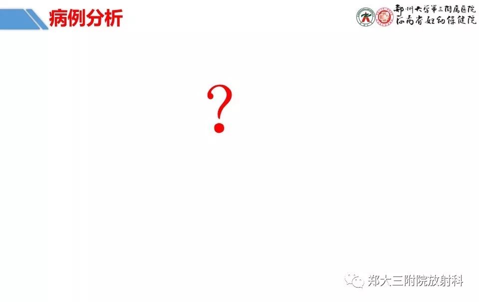 【PPT】卵巢肿瘤的影像诊断思路