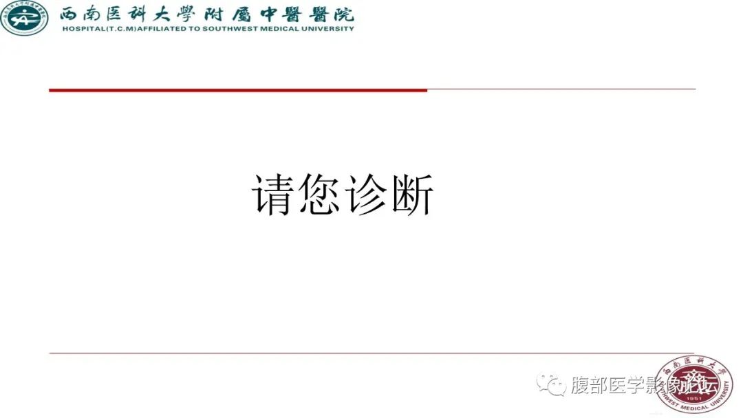 【病例】髂窝淋巴结炎性假瘤1例CT及MR影像诊断