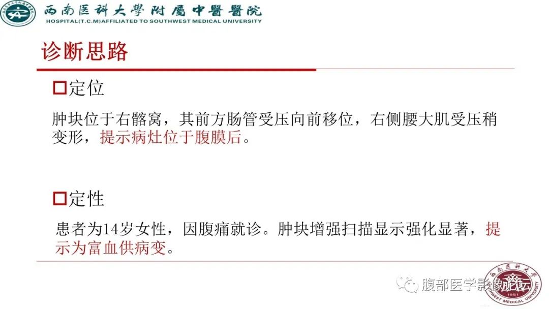 【病例】髂窝淋巴结炎性假瘤1例CT及MR影像诊断
