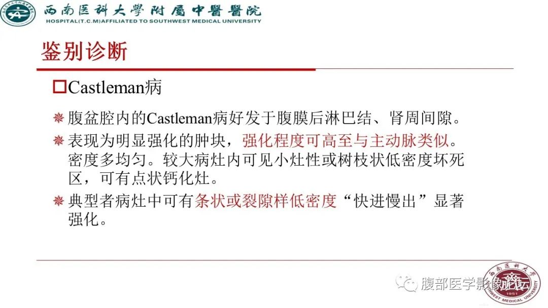 【病例】髂窝淋巴结炎性假瘤1例CT及MR影像诊断