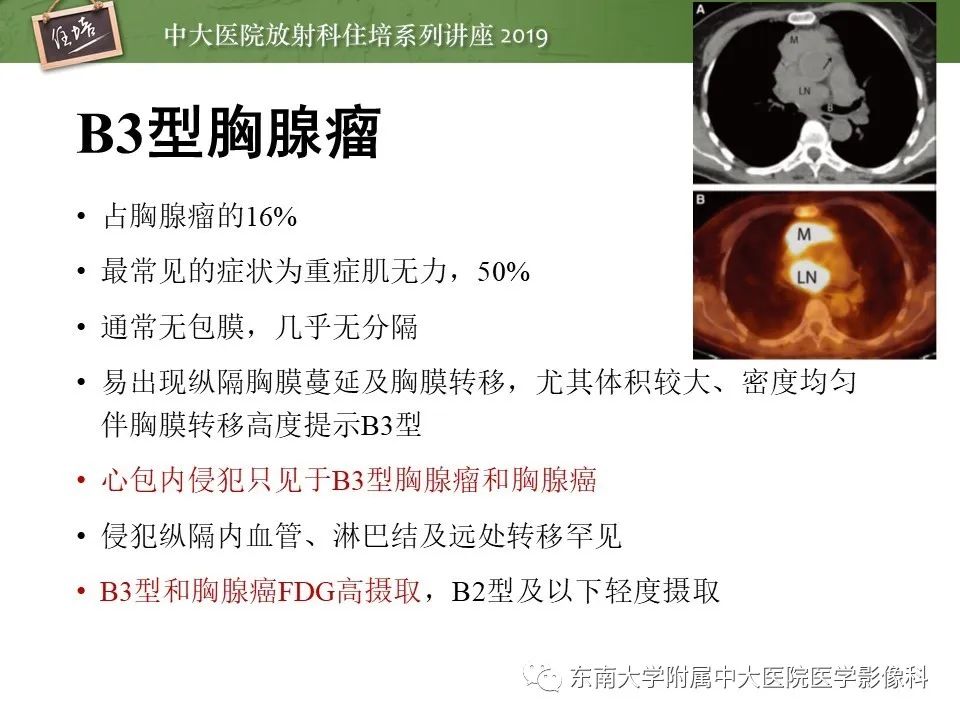 【PPT】胸腺上皮性肿瘤的影像诊断及鉴别