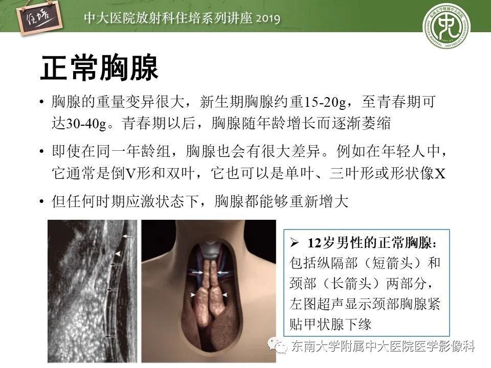 【PPT】胸腺上皮性肿瘤的影像诊断及鉴别