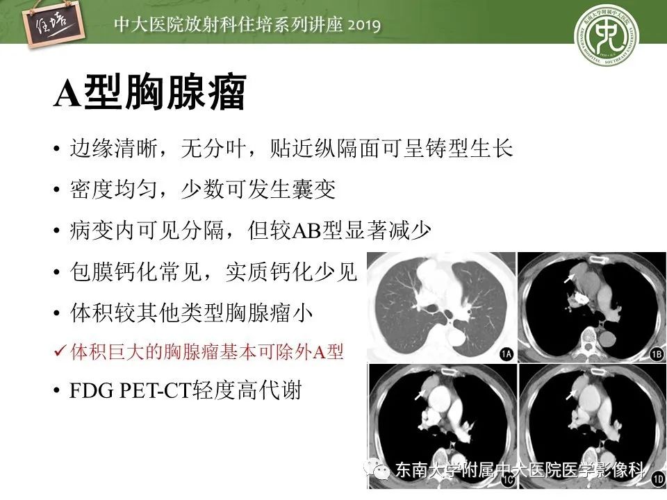【PPT】胸腺上皮性肿瘤的影像诊断及鉴别