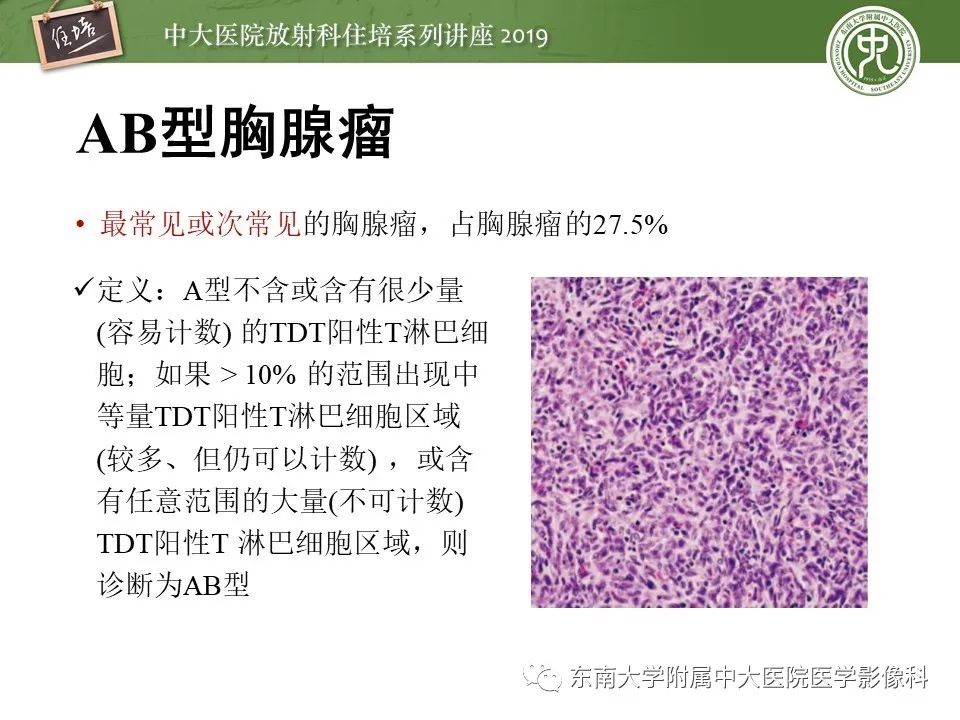 【PPT】胸腺上皮性肿瘤的影像诊断及鉴别